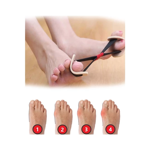 Periboia Ayak Baş Parmak Kemik Düzeltici Egzersiz Lastiği - 3