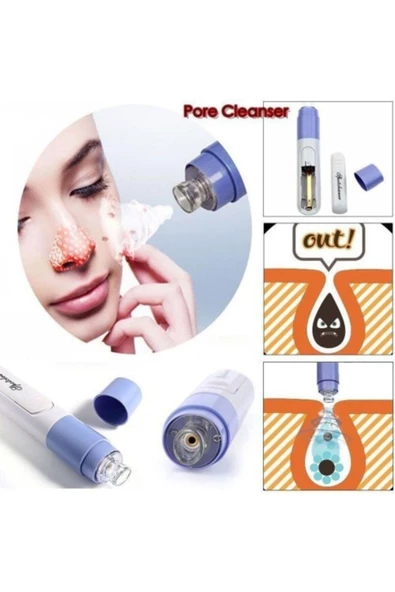 Pore Cleaner Temizleme Vakumlu Siyah Nokta Temizleme - 4