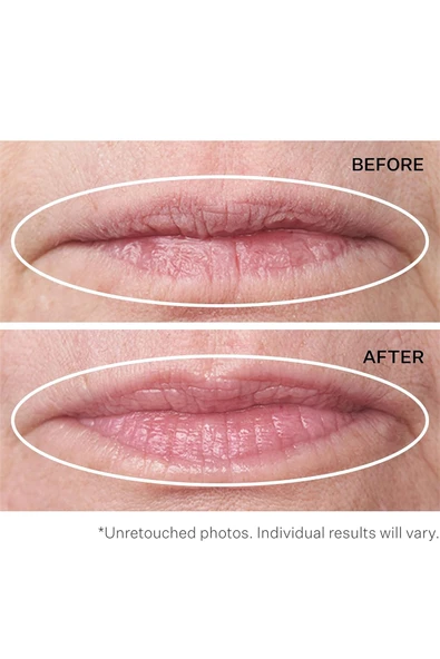 StriVectin Double Fix Dolgunlaştırıcı ve Dudak Çevresi Dikey Çizgi Bakımı 5ML - Resim 4