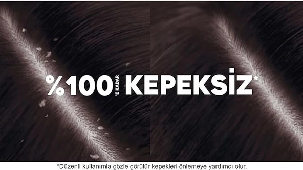 Head & Shoulders Besleyici Bakım Kepeğe Karşı Etkili Şampuan 350 ml - 4