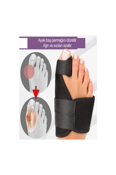 Halluks Gece Ateli Ayak Baş Parmak Kemik Çıkıntısı Düzeltici - 3