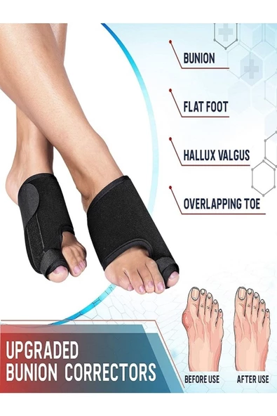 Newconcept Halluks Valgus Gece Ateli Ayak Bunyon Kemik Koruyucu 1 Çift (sağ Ve Sol) - 3
