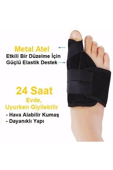 Halluks Valgus Ayak Ateli Ayak Başparmak Kemiği Çıkıntısı Bunyonu Düzeltici - 2