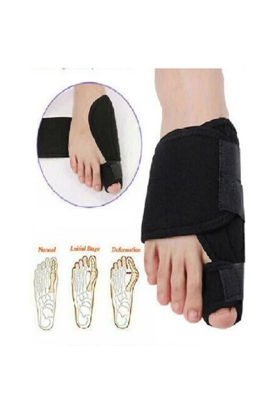 Gece Ateli Ayak Başparmak Kemiği Çıkıntısı Bunyonu 1 Çift Sağ Ve Sol 2 Adet - 5