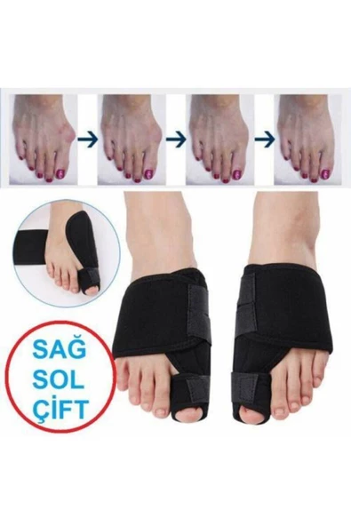 Halluks Valgus Gece Ateli Ayak Baş Parmak Kemik Çıkıntısı Düzeltici Bunyon Tedavisi - 5