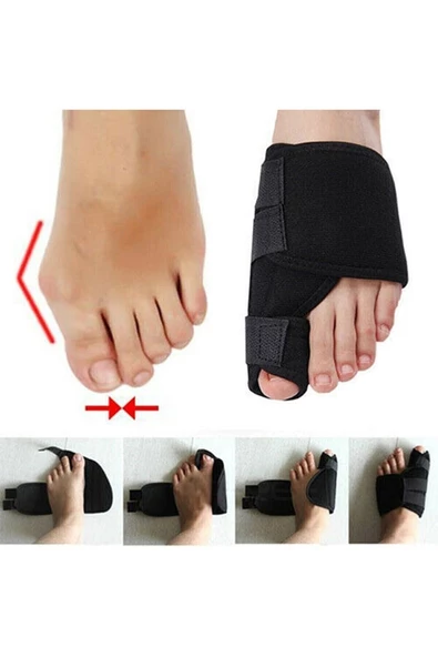 Halluks Valgus Ayak Ateli Ayak Başparmak Kemiği Çıkıntısı Bunyonu Düzeltici - 4