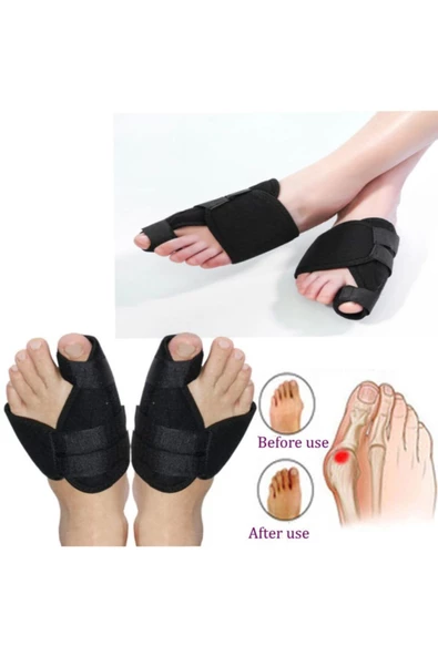 Medikal Ayak Başparmak Ateli Halluks Valgus Parmak Düzeltici 2’li - 4