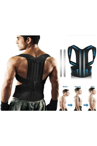 Medikal Unisex Çift Balenli Dik Duruş Korsesi Kifoz Skolyoz Korsesi Omuz Sırt Bel Korsesi - Resim 3