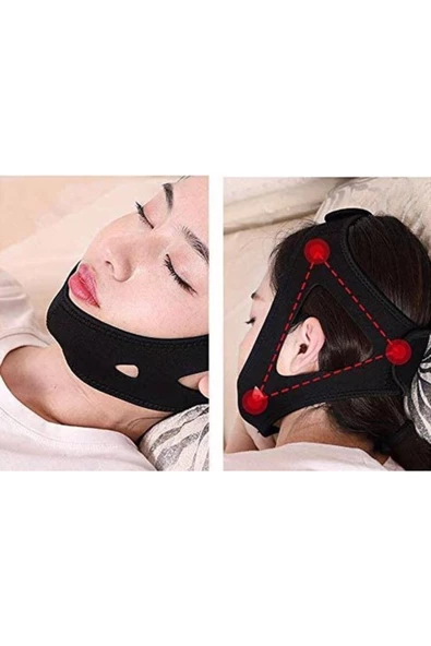 Medikal Horlama Bandı Horlama Önleyici Uyku Maskesi Horlama Protezi Horlama Bandı Maske - 4