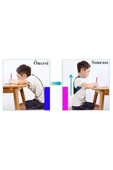 Ortopedik Çocuk Korsesi Dik Duruş Korsesi Omurga Kamburluk Önleyici Korse - 6