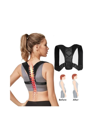 Ortopedik Sporcu Doğru Duruş Korsesi - Resim 2