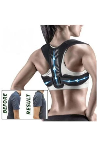 Medikal Ortopedik Dik Durus Korsesi Dik Durma Aparatı ürün görseli 1