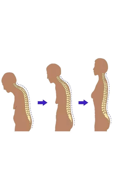 Unisex Siyah Medikal Balenli Ortopedik Kifoz Skolyoz Korsesi Dik Duruş Aparatı Dik Durmak İçin Korse - 5