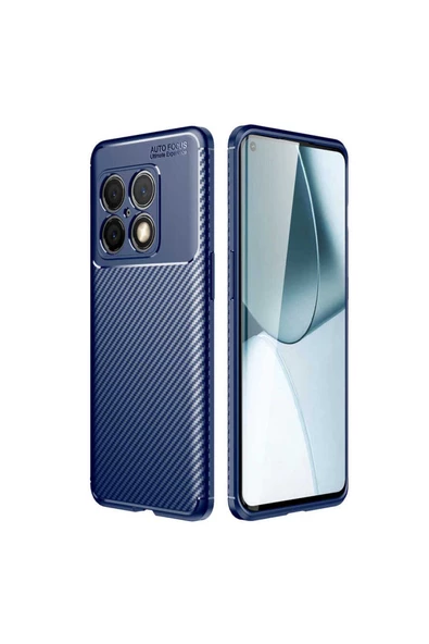 CEPCASE    One Plus 10 Pro Kılıf Karbon Fiber Tasarım Ultra Slim Lüx Görünüm Silikon Kapak ürün görseli