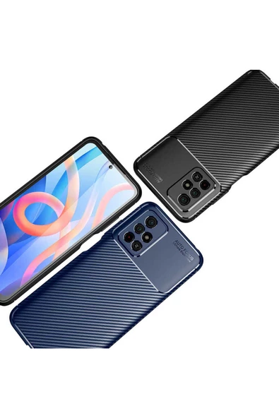 CEPCASE    Xiaomi Poco M4 Pro 5G Kılıf Karbon Fiber Tasarım Ultra Slim Lüx Görünüm Silikon Kapak - Resim 5