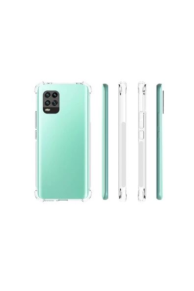 CEPCASE    Xiaomi Mi 10 Lite Kılıf Darbelere Dayanıklı Dört Köşe Airbag 2mm Anti Shock Silikon - Resim 3
