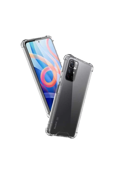 CEPCASE    Xiaomi Redmi Note 11t 5g Kılıf Darbelere Dayanıklı Dört Köşe Airbag 2mm Anti Shock Silikon