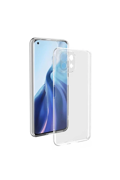 CEPCASE    Xiaomi Mi 11 Lite Kılıf Transparent Şeffaf Kamera Korumalı Camera Protected Kapak