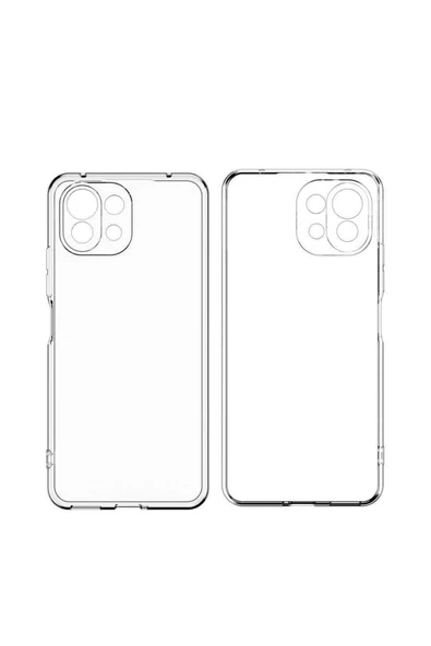 CEPCASE    Xiaomi Mi 11 Kılıf Transparent Şeffaf Kamera Korumalı Camera Protected Kapak