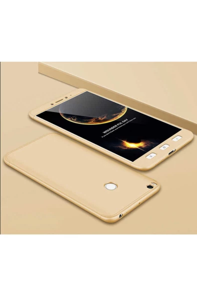 CEPCASE    Xiaomi Mi Max 2 Kılıf 3 Parça Tam Koruma Zore Ays Kapak