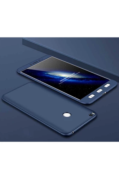 CEPCASE    Xiaomi Mi Max 2 Kılıf 3 Parça Tam Koruma Zore Ays Kapak