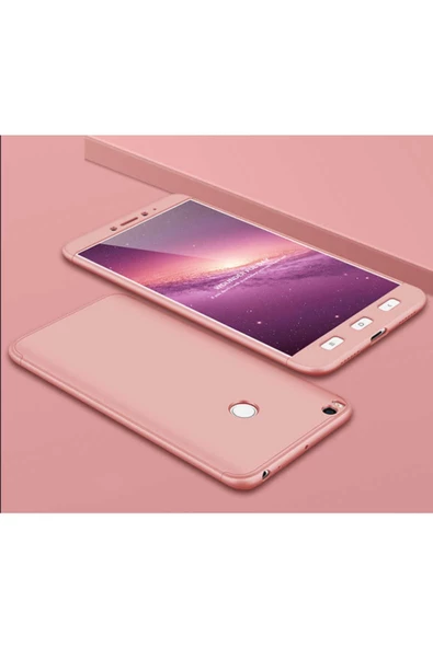 CEPCASE    Xiaomi Mi Max 2 Kılıf 3 Parça Tam Koruma Zore Ays Kapak