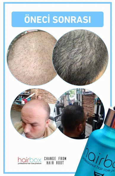 Hairbox Erkek Saç Serumu, Saç Serumu(5adet Serum Tarak ) - 4