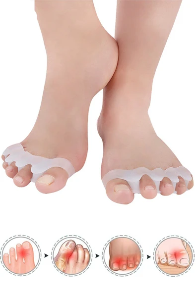 Makara Ayak 5 Parmak Ayıran Silikon Bunyon Koruyucu Parmak Ayırıcı Gece Ateli Halluks Valgus - Resim 2