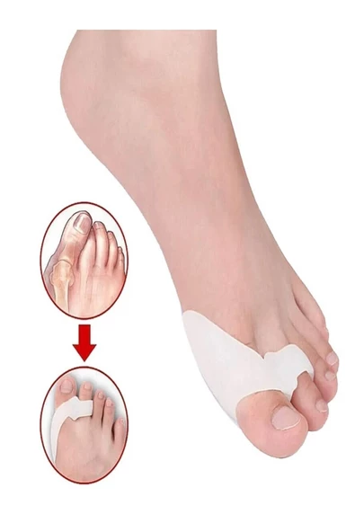Ayak Baş Parmak Kemik Koruyucu Bunyon Iki Parmağa Geçen Silikon Makaralı Başparmak Halluks Valgus - 4