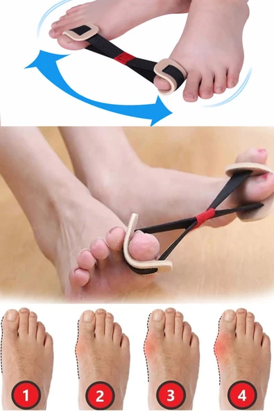 Ayak Parmak Egzersiz Lastiği Baş Parmak Kemik Düzeltici Aparat - Resim 2