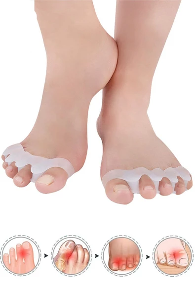Makara Ayak 5 Parmak Ayıran Silikon Bunyon Koruyucu Parmak Ayırıcı Gece Ateli Halluks Valgus - 2