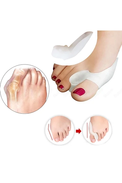 Silikon Makaralı Ayak Baş Parmak Kemik Bunyon Koruyucu Bunion Halluks Valgus Set Başparmak ürün görseli 1