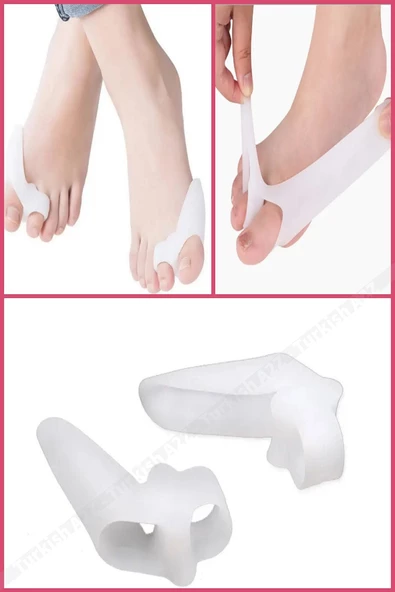 Ayak Baş Parmak Kemik Koruyucu Bunyon Iki Parmağa Geçen Silikon Makaralı Başparmak Halluks Valgus