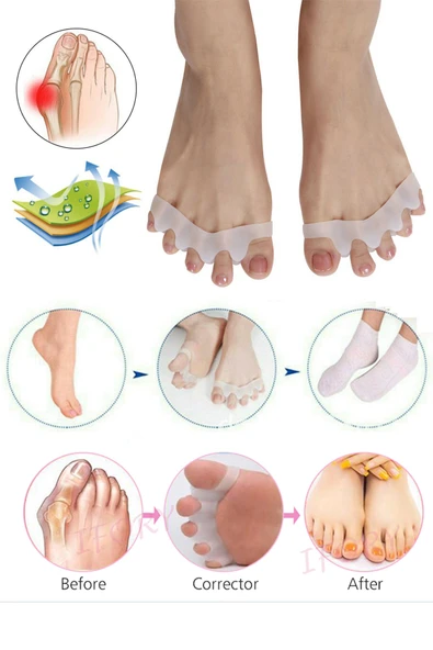 Makara Ayak 5 Parmak Ayıran Silikon Bunyon Koruyucu Parmak Ayırıcı Gece Ateli Halluks Valgus ürün görseli 1