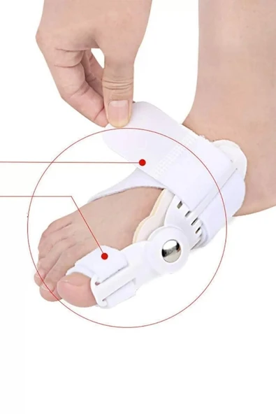 1 Adet Ayak Baş Parmak Kemik Düzeltici Halluks Valgus Ayak Bakımı Bunyon Koruyucu Gece Ateli ürün görseli 1
