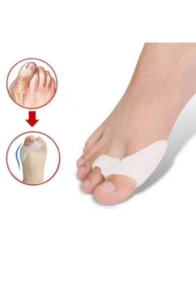 Orta Parmağa Geçen Metatarsal Pad - Resim 3