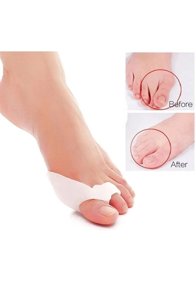 Orta Parmağa Geçen Metatarsal Pad - Resim 5