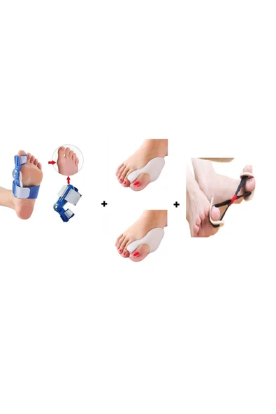 Ayak Baş Parmak Kemik Çıkıntısı Düzenleyici Aparat Bunyon Egzersiz Lastikli Set ürün görseli 1