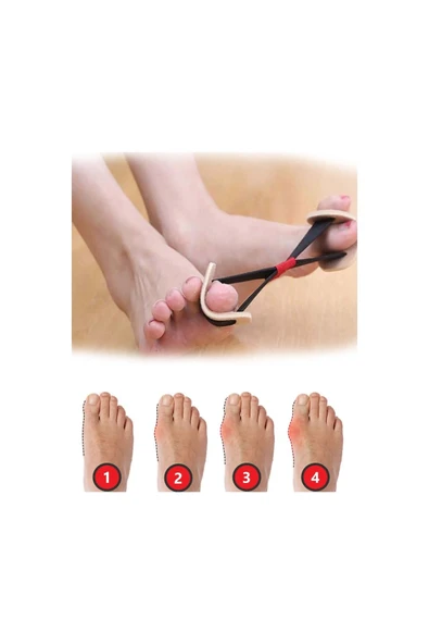 Ayak Baş Parmak Kemik Düzeltici Egzersiz Lastiği - Resim 3