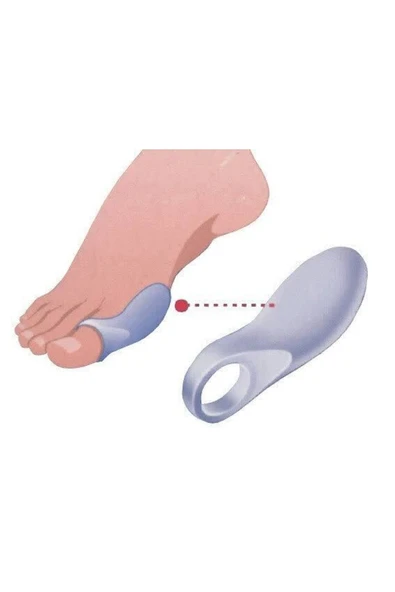 Ayak Başparmak Bunyon Koruyucu Makaralı 2li Set Koruma Aparatı Kampanya Indirim - Resim 4
