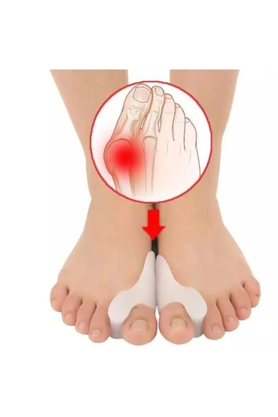 Ayak Başparmak Bunyon Koruyucu Makaralı 2li Set Koruma Aparatı Kampanya Indirim - Resim 2