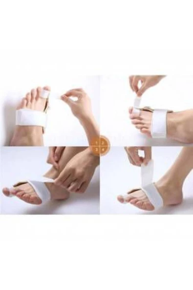 Ayak Bunyon Baş Parmak Kemik Koruyucu - Makaralı Kemik Düzeltici - 1 Adet Gece Ateli Düzeltici - 3