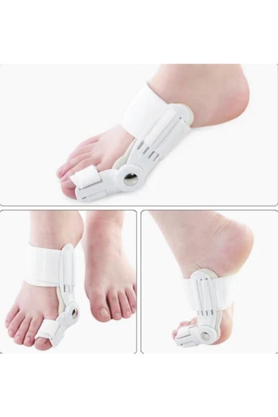 Ayak Bunyon Baş Parmak Kemik Koruyucu - Makaralı Kemik Düzeltici - 1 Adet Gece Ateli Düzeltici - 5