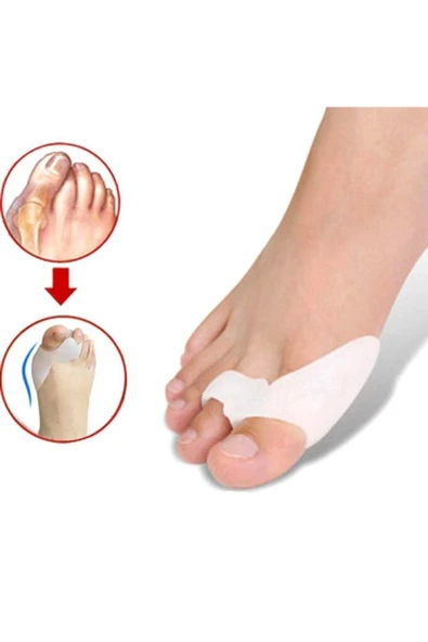 Silikon Baş Parmak Kemik Koruyucu Makaralı %100 Silikon