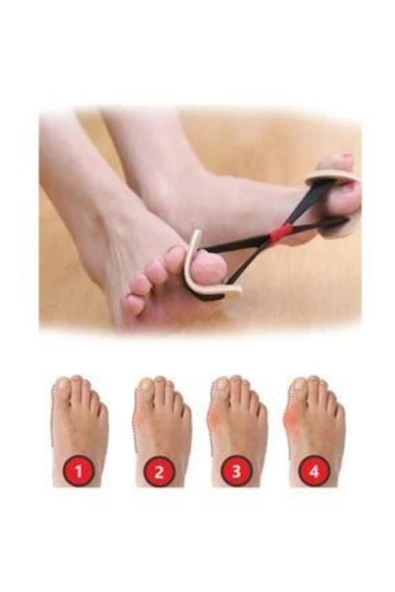 Ayak Baş Parmak Kemik Düzeltici Bunyon Hallux Vagus Egzersiz Lastik - 5