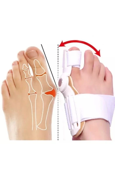 1 Adet Baş Parmak Eğriliği Aparat Kemik Bunyon Gece Ateli Halluk Valgus - Resim 2