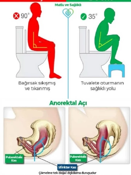 ElisGiftstore Katlanır Ayaklı Klozet Çömelme Ayak Taburesi, Wc Taburesi, Basamak Taburesi, Klozet Ayaklığı EH035 - 8