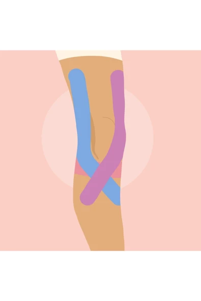 IRON Tape Kinesio Ağrı Bandı 5 Metre X 5 Cm Kırmızı - 5