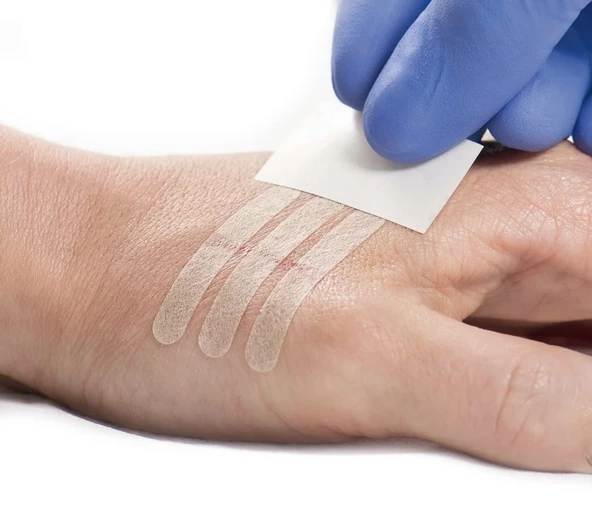 Hartmann Omnistrip Sabitleyici Bant 6x101 mm  ( TEKLİ PAKET) MEDİKAL - Resim 2