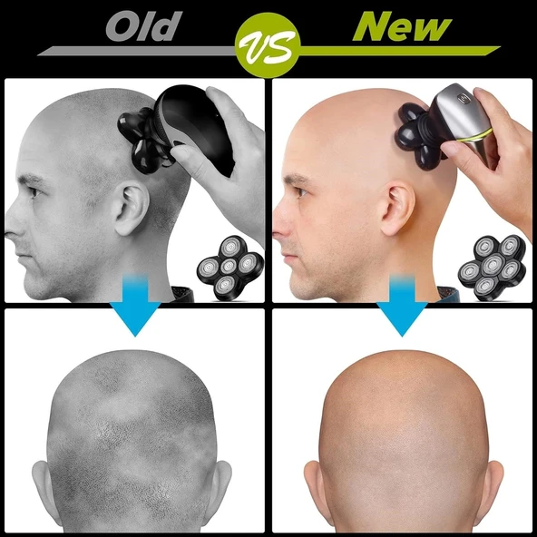 Telfun 6D Baş Tıraş Makinesi - Erkek/Kadın Bakımı - Çantası ile Birlikte - 3